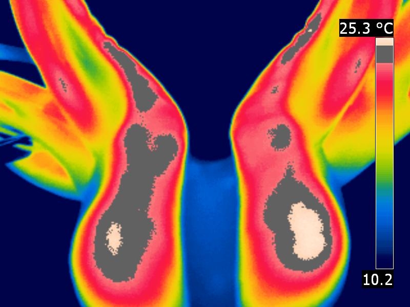 Sattelthermografie